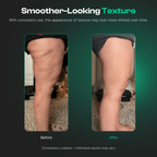 QORA ProSculpt 3-in-1