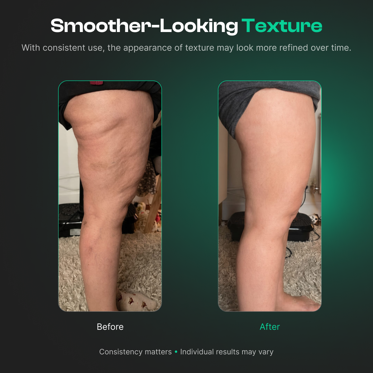 QORA ProSculpt 3-in-1